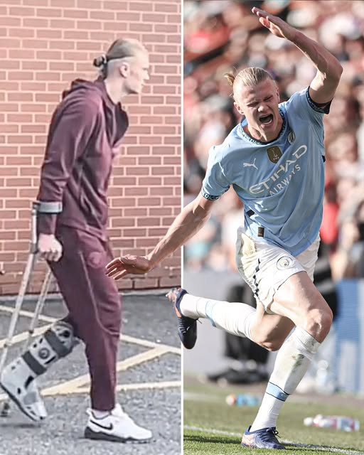 🚨 Erling Haaland Sparks Injury Fears After Leaving Vitality Stadium in a Walking Boot